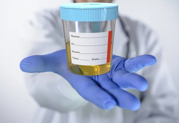 Container Urine Test Doctor Gloved Hand — Foto Stock
