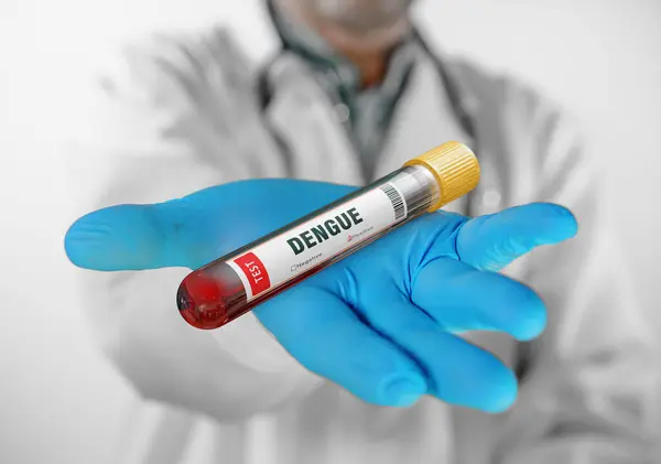 Bloedmonster Positief Met Dengue Virustest Stockafbeelding