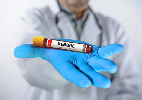 Bloedmonster Positief Met Dengue Virustest Rechtenvrije Stockafbeeldingen