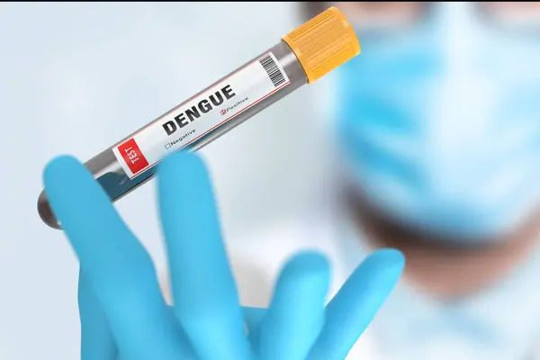 Campione Sangue Positivo Con Dengue Virus Test Foto Stock
