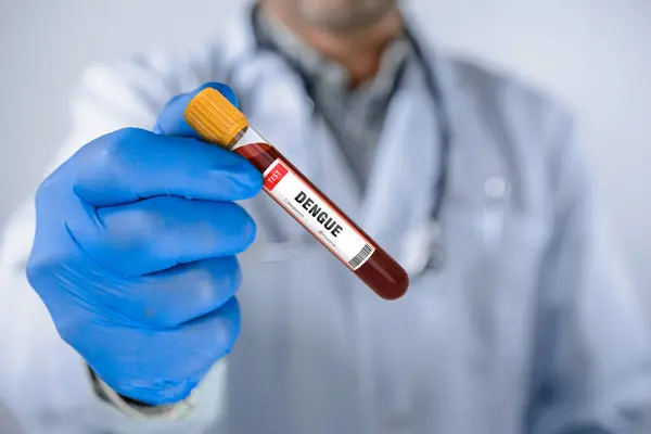 デングウイルス検査で陽性な血液サンプル ロイヤリティフリーのストック画像