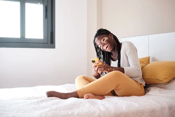 stock image Full body of cheerful young female with vitiligo disease sitting on bed and browsing smartphone in bedroom at home