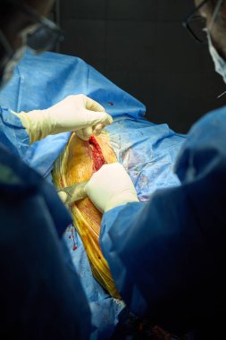 Ameliyathanede Bacak Ameliyatı Yapan Bir Cerrahın Kapanışı