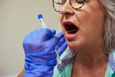 Sağlık uzmanı tıbbi ortamlarda genetik test veya hastalık teşhisi için Buccal çubuk kullanarak DNA örneği topluyor.