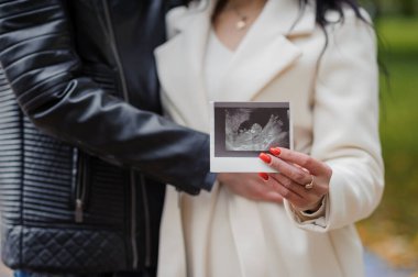 Bir erkek hamile karısına sarılır, kadın karnına yakın bir bebeğin ultrason fotoğrafını tutar.