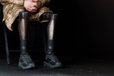 Bir Askerin Dayanıklılığı: Gelişmiş Biyonik Bacak Protezi Gösteriliyor.