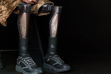 Gelişmiş Biyonik Bacak Protezi Modern Teknoloji ve Destekleyici Ayakkabıları Gösteriyor.