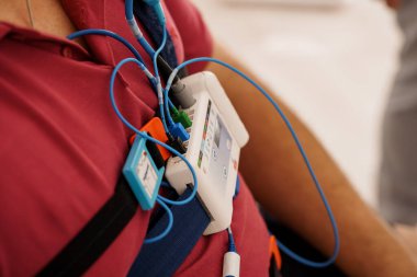 Detaylı bir çekimde mavi kablolar ve sensörlerle hayati belirtileri izleyen, uyku çalışması sırasında hastanın sırtına takılan taşınabilir bir polisomnografi cihazı görülüyor.