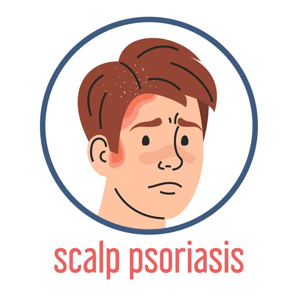 Scalp Psoriasis Vector Geïsoleerd Medische Aandoening Dermatologische Ziekte Trieste Man — Stockvector