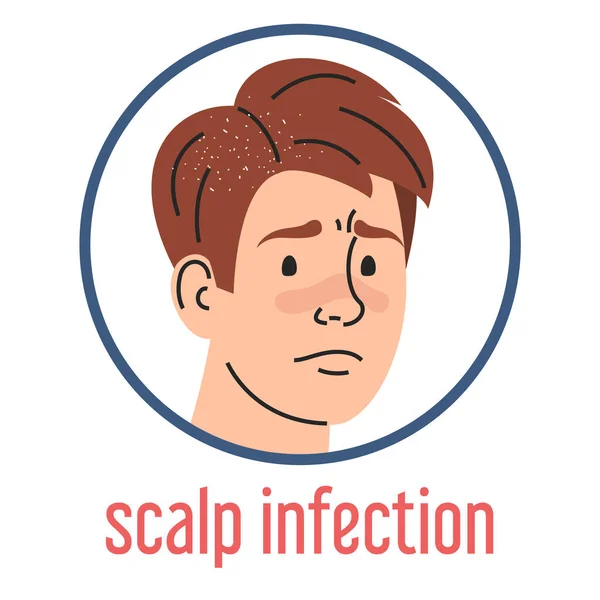 Scalp Infectie Vector Geïsoleerd Medische Aandoening Dermatologische Ziekte Droevige Man — Stockvector