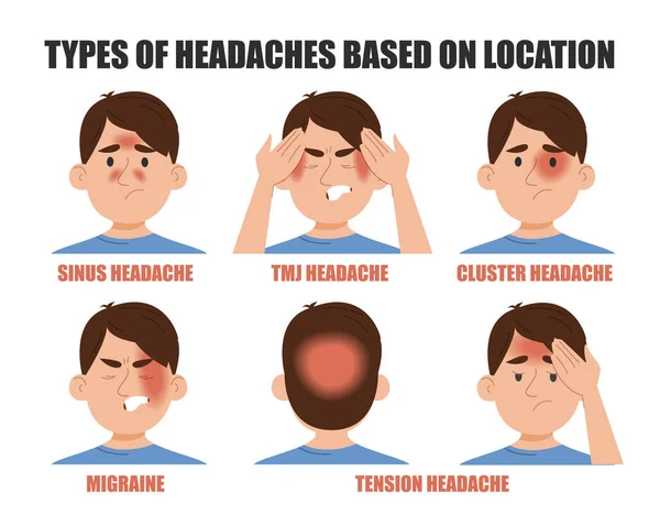 stock vector Types of headache based on location vector isolated. Pain in different areas of head. Migraine, sinus, cluster, tmj or tension headache. Man suffering from pain.