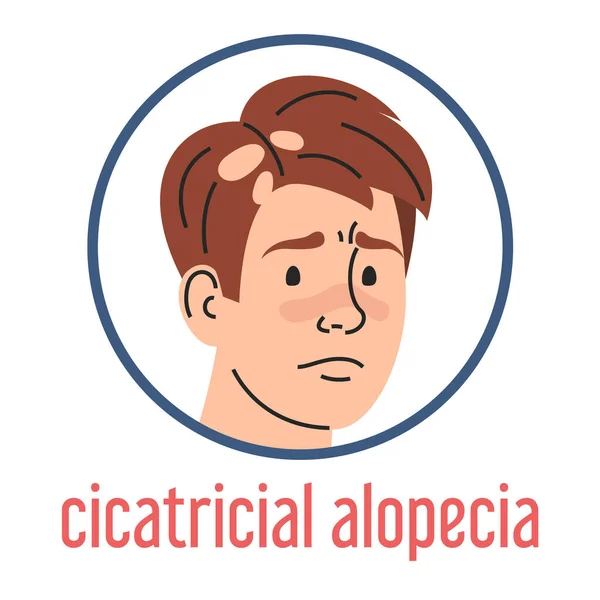 Vector Alopecia Cicatricial Aislado Retrato Hombre Triste Pérdida Cabello Condición — Vector de stock