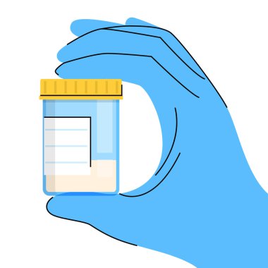 Tıbbi analiz vektörü izole etmek için üzerinde sperm örneği olan plastik bir kap tutan mavi eldiven verin. Tıp, biyoloji ve sağlık hizmetleri kavramı. Sperm bağışı.