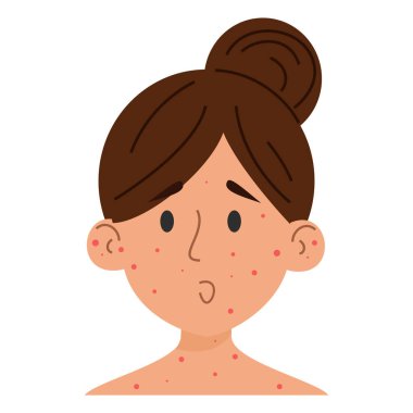 Vücudunun her yerinde kızarıklıklar ve yüz vektörü olan bir kadın izole edilmiş. Kaşındıran yaralardan muzdarip bir kadın karakteri tasviri. Bulaşıcı hastalık belirtileri, cilt tahrişi.