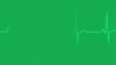 Monitördeki kalp atışı hattı..