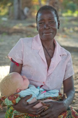Xai Xai Mozambik: Albino çocuğa bakan kadın, elinde uyuyan bir çocuğun gölgesinde oturuyor.
