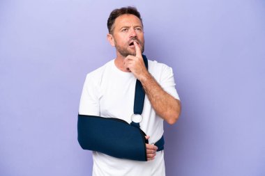 Kırık kollu orta yaşlı beyaz bir adam ve mor arka planda izole edilmiş bir askı takıyor.