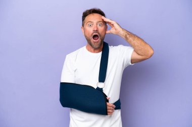 Kırık kollu orta yaşlı beyaz bir adam ve mor arka planda izole edilmiş bir askı takıyor.