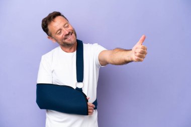 Orta yaşlı, kolları kırık, askı takan, mor arka planda yaşayan beyaz bir adam baş parmak işareti yapıyor.