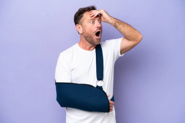 Kırık kollu orta yaşlı beyaz bir adam ve mor arka planda izole edilmiş askısı var. Yan tarafa bakarken sürpriz jest yapıyor.