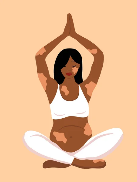 Femme Enceinte Avec Vitiligo Faire Yoga Méditation Vecteur — Image vectorielle