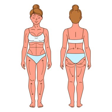 Kadın Vücut Yağ Aldırma İşaretleri Ön ve Arka. Yağ aldırma ve vücut hatları için işaretlenmiş bölgeleri olan bir kadının ön ve arka görüntüsünü gösteren vektör illüstrasyonuName