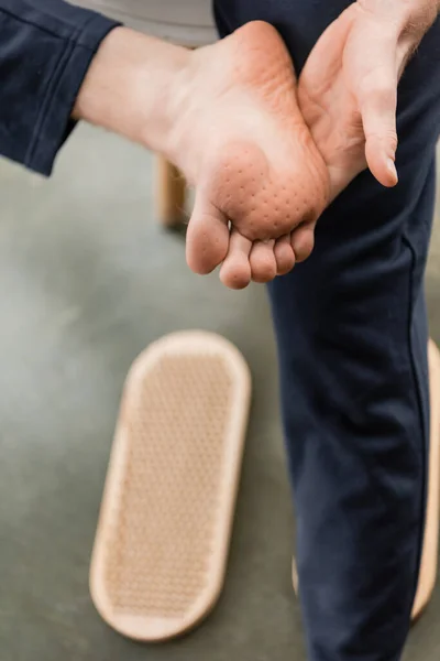 Visão Parcial Homem Mostrando Pés Descalços Após Prática Unhas Perto — Fotografia de Stock