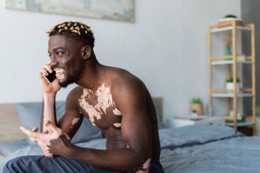 Vitiligo 'su olan neşeli Afro-Amerikalı adam yatak odasında akıllı telefondan konuşuyor. 