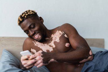 Vitiligo 'su olan tişörtsüz Afro-Amerikalı adam akıllı telefon kullanıyor ve yatak odasında gülümsüyor. 