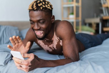 Vitiligo 'su olan neşeli Afro-Amerikalı adam yatağında akıllı telefondan video görüşmesi yapıyor. 