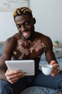 Vitiligo 'su olan gülümseyen Afrikalı Amerikalı adam dijital tablet kullanıyor ve yatak odasında kahve fincanı tutuyor. 