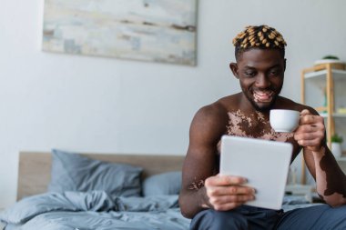 Vitiligo 'su olan tişörtsüz Afro-Amerikalı adam dijital tablet kullanırken gülümsüyor ve yatak odasında bir fincan kahve tutuyor. 