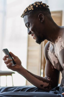 Gülümseme ve üstsüz Afrikalı Amerikalı Vitiligo 'lu adamın yatak odasında cep telefonu tutuşu. 