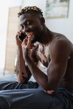 Pozitif ve üstsüz Vitiligo 'lu Afro-Amerikan adam yatakta akıllı telefonla konuşuyor. 