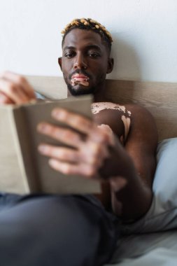 Vitiligo ile gömleksiz Afro-Amerikalı adam yatakta bulanık kitap okuyor. 