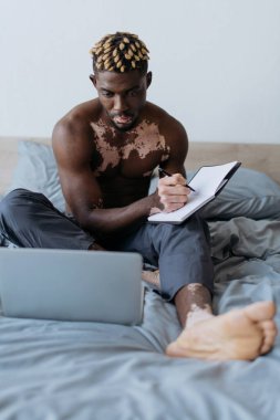 Vitiligo 'su olan tişörtsüz Afro-Amerikalı adam dizüstü bilgisayarın yanında yazıyor evde yatağında. 