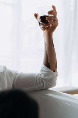 Vitiligo tişörtlü Afro-Amerikan bir adamın elinde bir bardak viski tutarken çekilmiş görüntüsü. 