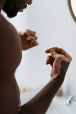 Vitiligo 'lu Afro-Amerikan bir adamın banyoda diş tutarken çekilmiş görüntüsü. 