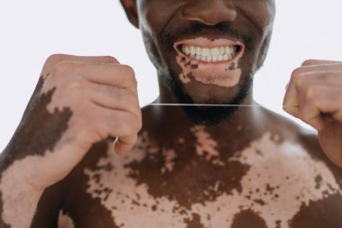 Vitiligo 'su olan ve evinde diş ipi tutan üstsüz Afro-Amerikan bir adam. 