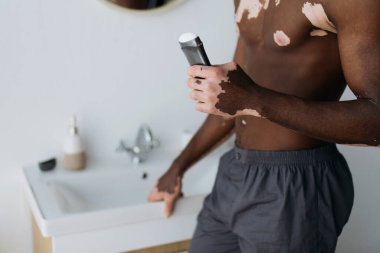 Vitiligo 'lu kaslı Afro-Amerikalı adamın banyoda terleme önleyici tutuşu. 