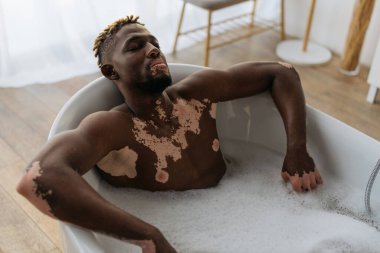 Vitiligo 'su olan genç Afrikalı Amerikalı adam evde küvette dinleniyor. 