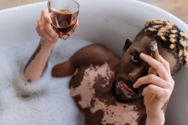Vitiligo 'lu Afro-Amerikan bir adam elinde puro ve viskiyle küvette köpükle kameraya bakarken görülüyor. 
