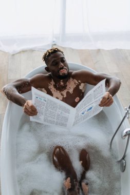 Vitiligo 'su olan ve evde banyo yaparken gazete okuyan Afro-Amerikan bir adam. 