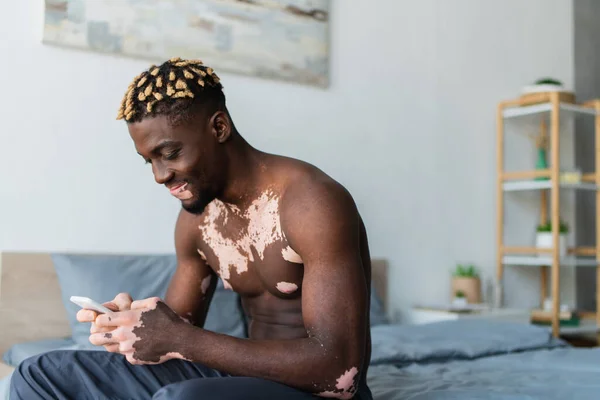 stock image Smiling african american man with vitiligo using smartphone on bed at home 