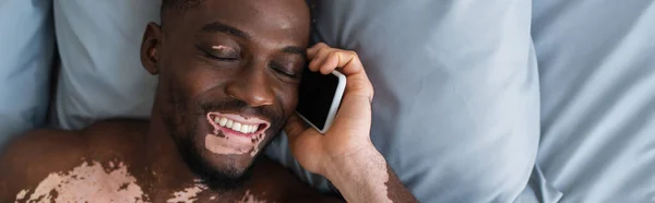 Top view of positive african american man with vitiligo talking on mobile phone on bed, banner