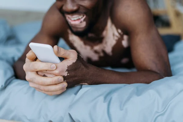 Περικοπή Άποψη Του Θολή Αφροαμερικανός Άνθρωπος Λεύκη Χρησιμοποιώντας Smartphone Στο — Φωτογραφία Αρχείου