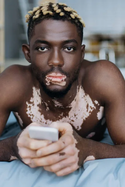 アフリカ系アメリカ人の男性の肖像で 自宅でベッドの上に横たわっている間にスマートフォンを持ち カメラを見ています — ストック写真