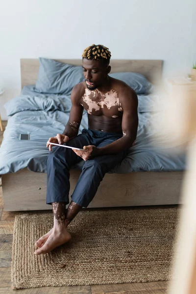 シャープなアフリカ系アメリカ人男性とともにVitiligo使用デジタルタブレットながら座っている間にベッドに家 — ストック写真