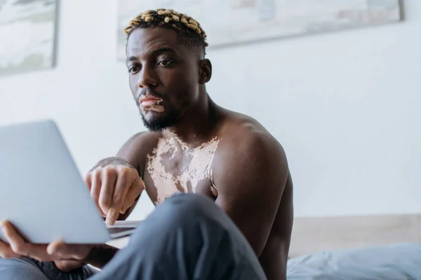 Shirtless Αφρικής Αμερικανός Άνθρωπος Λεύκη Χρησιμοποιώντας Φορητό Υπολογιστή Στο Υπνοδωμάτιο — Φωτογραφία Αρχείου