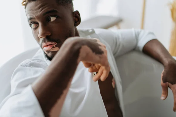 Afro Amerikaanse Man Met Vitiligo Shirt Zitten Bad Thuis — Stockfoto
